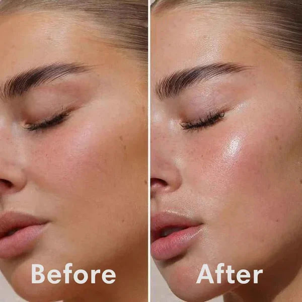 Before and after comparison of a woman's face with 'Before' on the left and 'After' on the right.