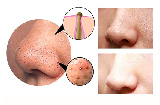 Skin Sculptor